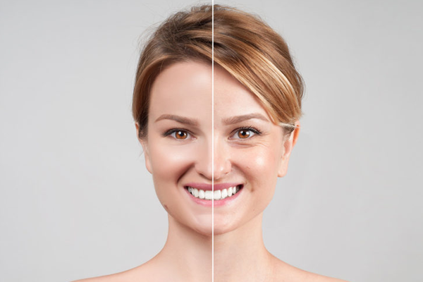 Toxina-Butolinica-Botox-Spamedica-Panama Toxina-Butolinica-Botox-Spamedica-Panama