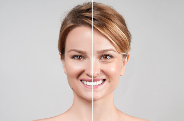 Toxina-Butolinica-Botox-Spamedica-Panama